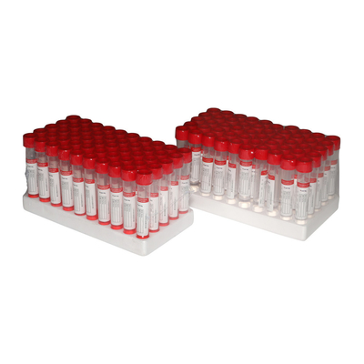 کیت های مجموعه 3 میلی لیتری Poweray Nasal Swab VTM با سواب PCR Dacron