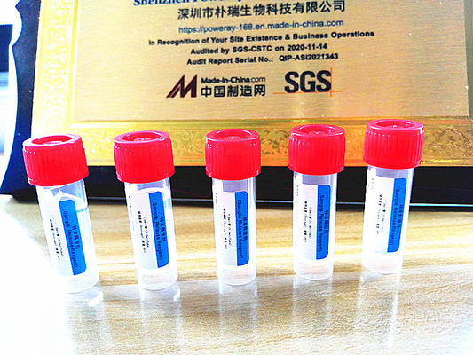 کیت خانگی تست PCR تایید SGS استخراج DNA و RNA برای کووید-19